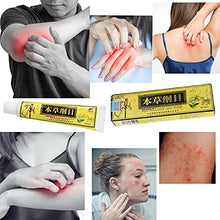 Load image into Gallery viewer, 5pcs New Chinese Herbal Eczema Psoriasis Creams Dermatitis and Eczema Pruritus Psoriasis Ointment
