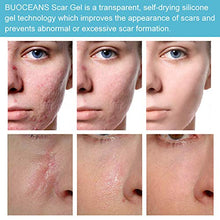 Load image into Gallery viewer, Scar Removal Cream, Scar Cream, Stretch Mark Cream, Natural Formula, Scar Gel Medical-Grade Silicone for Face, Body, C-Sections, Surgical, Burn, Acne Spots, Old &amp; New Scars, 20g
