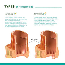 Load image into Gallery viewer, Reejoys Hemorrhoid Cream, Hemorrhoid Treatment, Hemorrhoid &amp; Fissure Ointment, Fast Relief Hemorrhoid Cream Healing Formula, Hemorrhoid Symptom Ointment… (0.9 oz)

