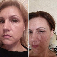 Load image into Gallery viewer, Luxury Dark spot remover for Face and Body Serum - Age spot corrector Acne scar - Anti aging - Bleaching Vitamin C organic Swiss brand Magiclear 30 ml
