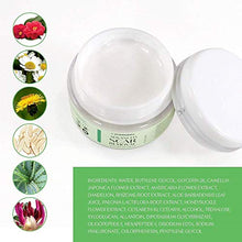 Load image into Gallery viewer, Scar Removal Cream - Advanced Treatment for Face &amp; Body, Old &amp; New Scars from Cuts, Stretch Marks, C-Sections &amp; Surgeries - With Natural Herbal Extracts Formula

