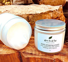 Load image into Gallery viewer, MSM Cream Rosacea Eczema Psoriasis Scars
