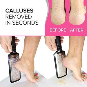 Genuine feet scrubber dead skin remover for feet (Large) Foot file callus remover foot scrubber dead skin remover foot rasp - Heel scraper for feet foot file for dead skin foot grater for dead skin