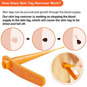 Skin Tag Remover, Skin Tag Removal Kit with 36 PCS Skin Tag Repair Patches, Efficient Skin Tag Remover Kit for Medium to Large Skin Tags