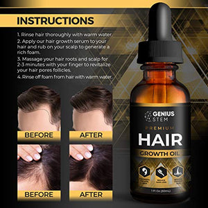 GENIUS Hair Growth Oil, Biotin Hair Growth Serum, for Stronger, Thicker, Longer Hair, Hair Growth Treatment for Women Men With Thinning Hair Loss Serum 1fl oz