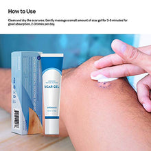 Load image into Gallery viewer, Aroamas Silicone Scar Gel, 30g, Silicone Scar Gel for Surgical Scars, for Face, Scar Gel with Silicone for Keloids, C-Section, Cosmetic Procedures, Burns, Injuries
