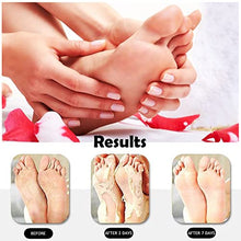 Load image into Gallery viewer, STRIDE Foot Cream Smoothes Rough &amp; Dry Skin –– Dematologist-Developed, Intensely Moisturizing Foot Cream with Aloe Vera, Coconut oil and Green tea
