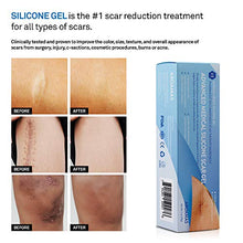 Load image into Gallery viewer, Aroamas Silicone Scar Gel, 30g, Silicone Scar Gel for Surgical Scars, for Face, Scar Gel with Silicone for Keloids, C-Section, Cosmetic Procedures, Burns, Injuries
