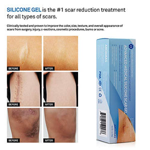 Aroamas Silicone Scar Gel, 30g, Silicone Scar Gel for Surgical Scars, for Face, Scar Gel with Silicone for Keloids, C-Section, Cosmetic Procedures, Burns, Injuries
