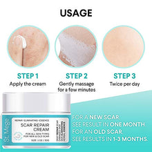 Load image into Gallery viewer, Scar Removal Cream, Scar Cream For Old Scars - Stretch Mark Removal Cream for Men &amp; Women - Stretch Marks Relief and Burns Repair, Face Skin Repair Cream
