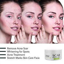 Load image into Gallery viewer, Scar Removal Cream For Old Scars -Stretch Mark Removal Cream for Men and Women Stretch Marks Relief and Burns Repair,Face Skin Repair Cream
