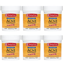 Load image into Gallery viewer, De La Cruz 10% Sulfur Ointment Acne Treatment - Medication to Clear Cystic Acne Pimples and Blackheads on Face and Body - Made in USA - 2.6 oz (6 Pack)
