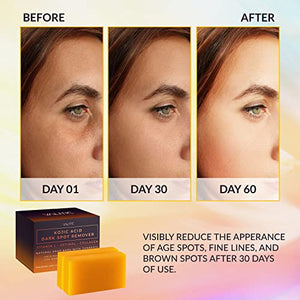 VALITIC 2-Pack Kojic Acid Dark Spot Remover Soap Bars & 1 Pair (Black) Style Korean Exfoliating Gloves for Body Scrub