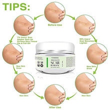 Load image into Gallery viewer, Scar Removal Cream - Advanced Treatment for Face &amp; Body, Old &amp; New Scars from Cuts, Stretch Marks, C-Sections &amp; Surgeries - With Natural Herbal Extracts Formula
