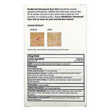 Load image into Gallery viewer, Mederma Advanced Scar Gel, 1.76 oz (50 g)
