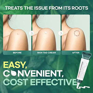 Skin Tag Remover Cream for Safe & Effective Skin Tag Removal, Natural Ingredients, Korean Skin Care