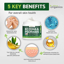 Load image into Gallery viewer, Psoriasis &amp; Eczema Cream - Natural Eczema Treatment with Tea Tree Oil, MSM, Honey &amp; Arnica - Made in USA - Powerful Dermatitis, Irritation &amp; Psoriasis Treatment - Steroid-Free Psoriasis Cream - 4OZ
