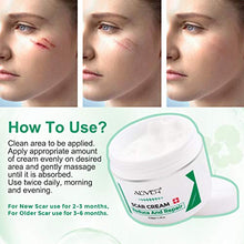 Load image into Gallery viewer, Scar Remover Cream, Reduce and Repair Skin, from C-Section, Acne, Surgery, Burns, Face Sacne, Effective for both Old and New Scars, Best Scar Removal Cream for Kids, Women, Men, 50Ml
