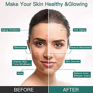 LEIUKS Green Tea Mask, Matcha Green Tea Face Mask, Deep Washing Blackhead Remover Mask, Green Tea Cleansing mask for Wrinkles, Blackheads, Pore, Acne for Women, Men - 5.3 OZ