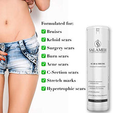 Load image into Gallery viewer, Doctor Salameh Scar and Bruise Cream Reduces The Appearance of Scars and Skin Discoloration with Arnica Oil and Vitamins K and E (1 oz)
