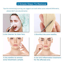 Load image into Gallery viewer, 5PCS Blackhead Remover Comedone Extractor, Curved Blackhead Tweezers Kit, Professional Stainless Pimple Acne Blemish Removal Tools Kit
