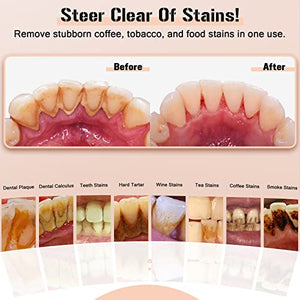 Plaque Remover for Teeth, Electric Tooth Cleaner Tartar Remover for Teeth with LED Light,4 Modes Rechargeable Teeth Cleaning Kit with Dental Tools, 2 Replaceable Heads