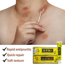 Load image into Gallery viewer, 5pcs New Chinese Herbal Eczema Psoriasis Creams Dermatitis and Eczema Pruritus Psoriasis Ointment
