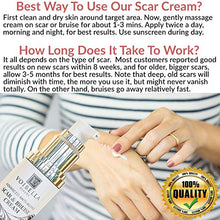 Load image into Gallery viewer, Scar &amp; Bruise Removal Cream - Best Treatment Remedy for Healing, Skin Repair, Fading &amp; Prevention of Old or New Acne &amp; Stretch Mark, Surgical, Keloid, C Section, Pregnancy or Bug Bite Scars &amp; Bruises
