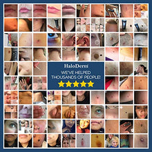Load image into Gallery viewer, HaloDerm Advanced Skin Tag Remover &amp; Mole Remover - All Natural Skin Tag Cream - Remove up to 10 Skin Tags (FAST Results In As Little As 3-5 Applications) (1 Pack)
